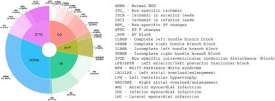 Convolutional neural network (CNN)-enabled electrocardiogram (ECG) analysis: a comparison between standard twelve-lead and single-lead setups